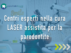 Cura Parodontite con Laser a Genova